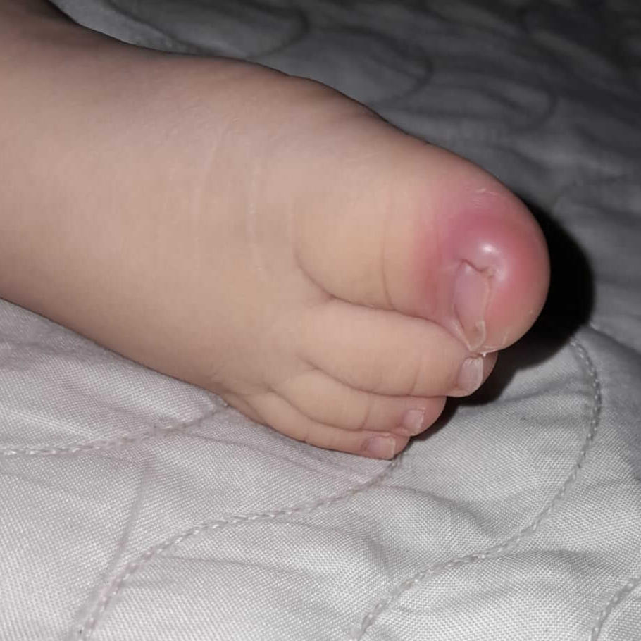 pediátricos